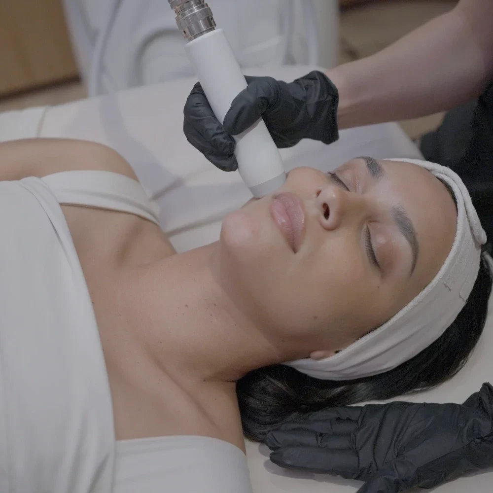 T-Shape 2 facial treatment on the cheek at iCRYO Grosse Pointe
