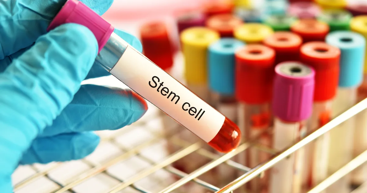 Comparing stem cell IV therapy and PRP regenerative options at iCRYO Grosse Pointe